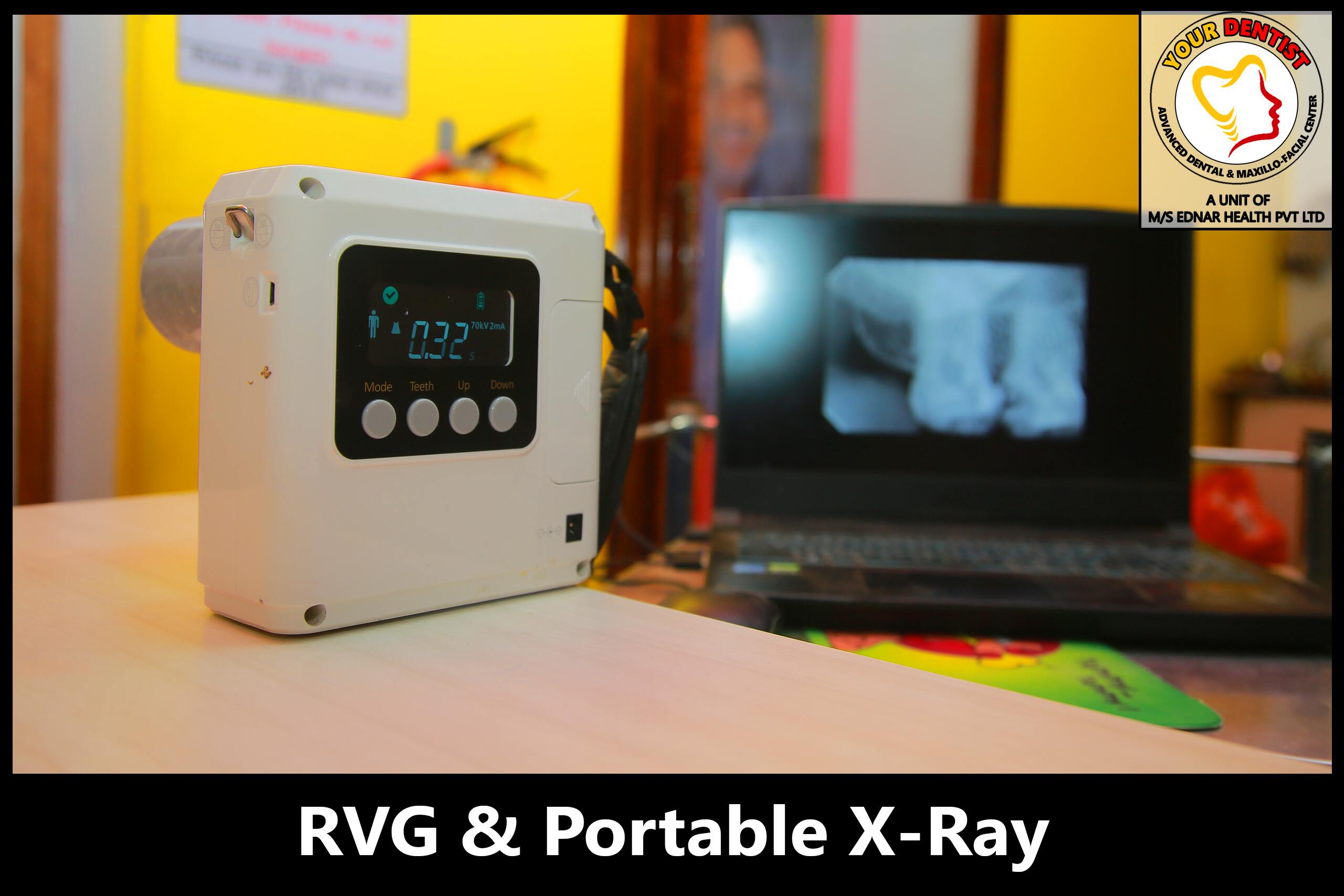 RVG & Portable X-Ray